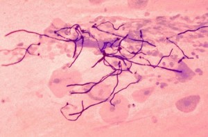 Нити-псевдомицедлия-гриба-Кандида-под-микроскопом
